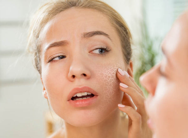 Tips from skin therapists how to avoid skin dryness